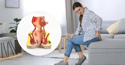 Understanding Hemorrhoids and its treatment options
